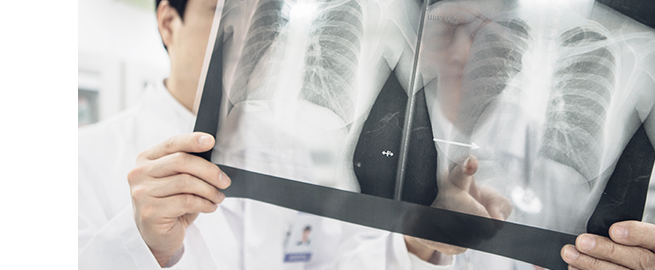 Chuẩn bị gây mê an toàn thông qua kiểm tra trước phẫu thuật (X-Ray)