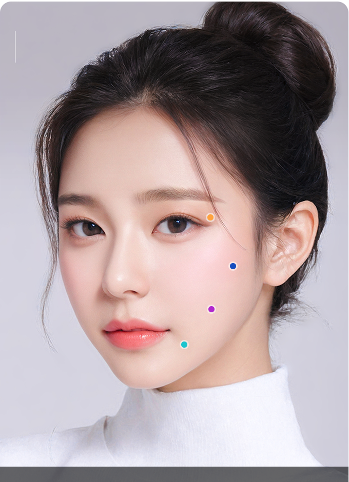 Người mẫu Baby Face Mini Lifting với các vùng lo lắng được đánh dấu như má chảy xệ và nếp gấp mũi - má