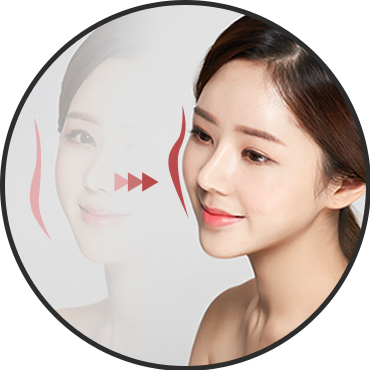 Đường nét — đường gò má nhìn nghiêng 45 độ (Ogee Curve)
