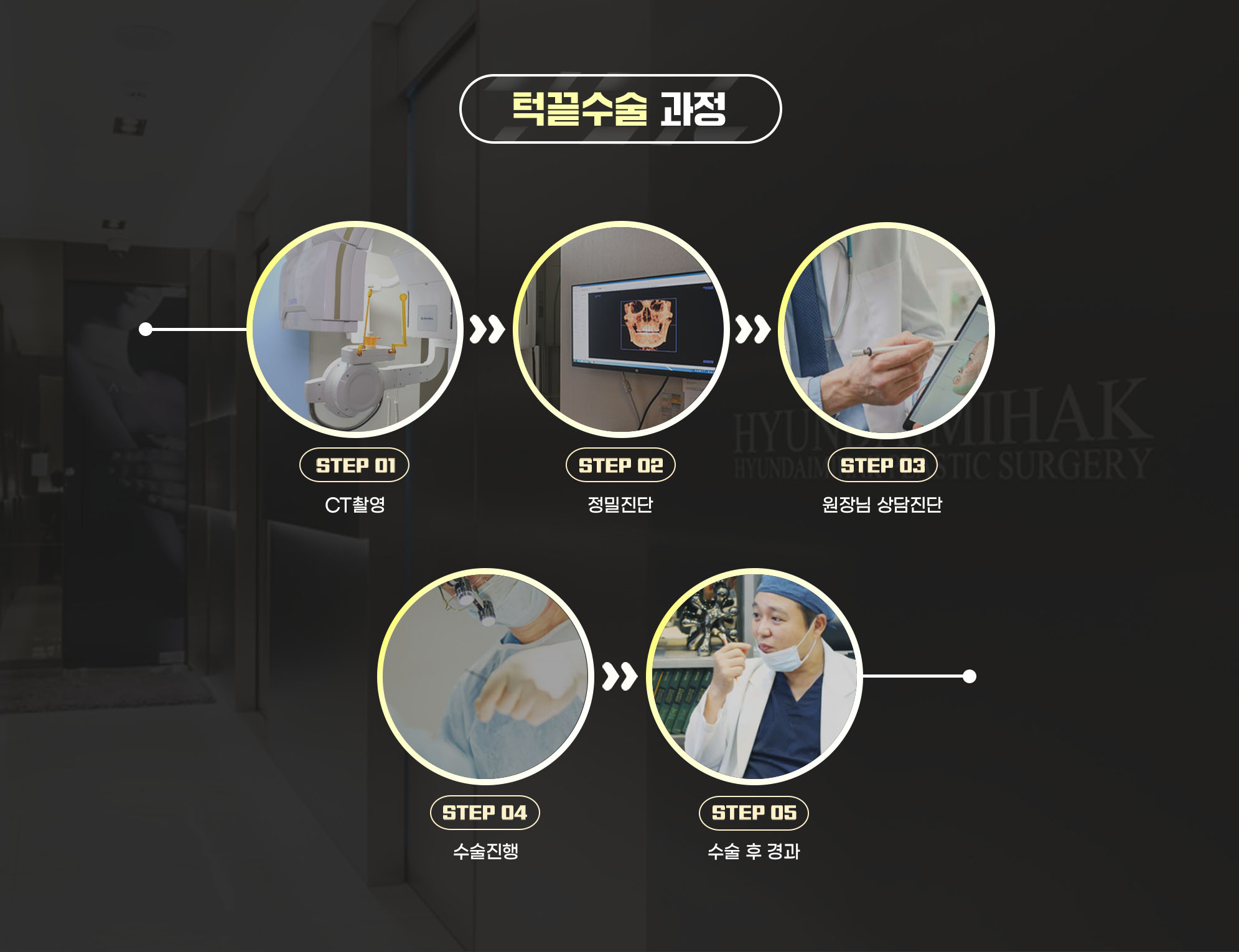 Quy trình phẫu thuật đầu cằm — STEP 01 Chụp CT, STEP 02 Chẩn đoán chuyên sâu, STEP 03 Tư vấn chẩn đoán với bác sĩ trưởng khoa, STEP 04 Tiến hành phẫu thuật, STEP 05 Theo dõi sau phẫu thuật