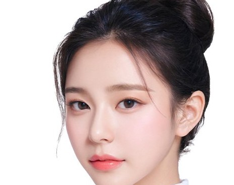 Người mẫu kết quả phẫu thuật mở đuôi mắt - đôi mắt được mở rộng theo chiều ngang, thoáng rõ