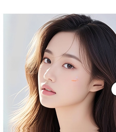 Ảnh ví dụ kết quả phẫu thuật cắt mí 2