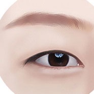 Minh họa STEP 01 giai đoạn thiết kế trong phẫu thuật cắt mí