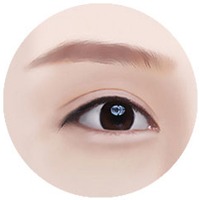 Minh họa STEP 04 giai đoạn hoàn thiện trong phẫu thuật cắt mí