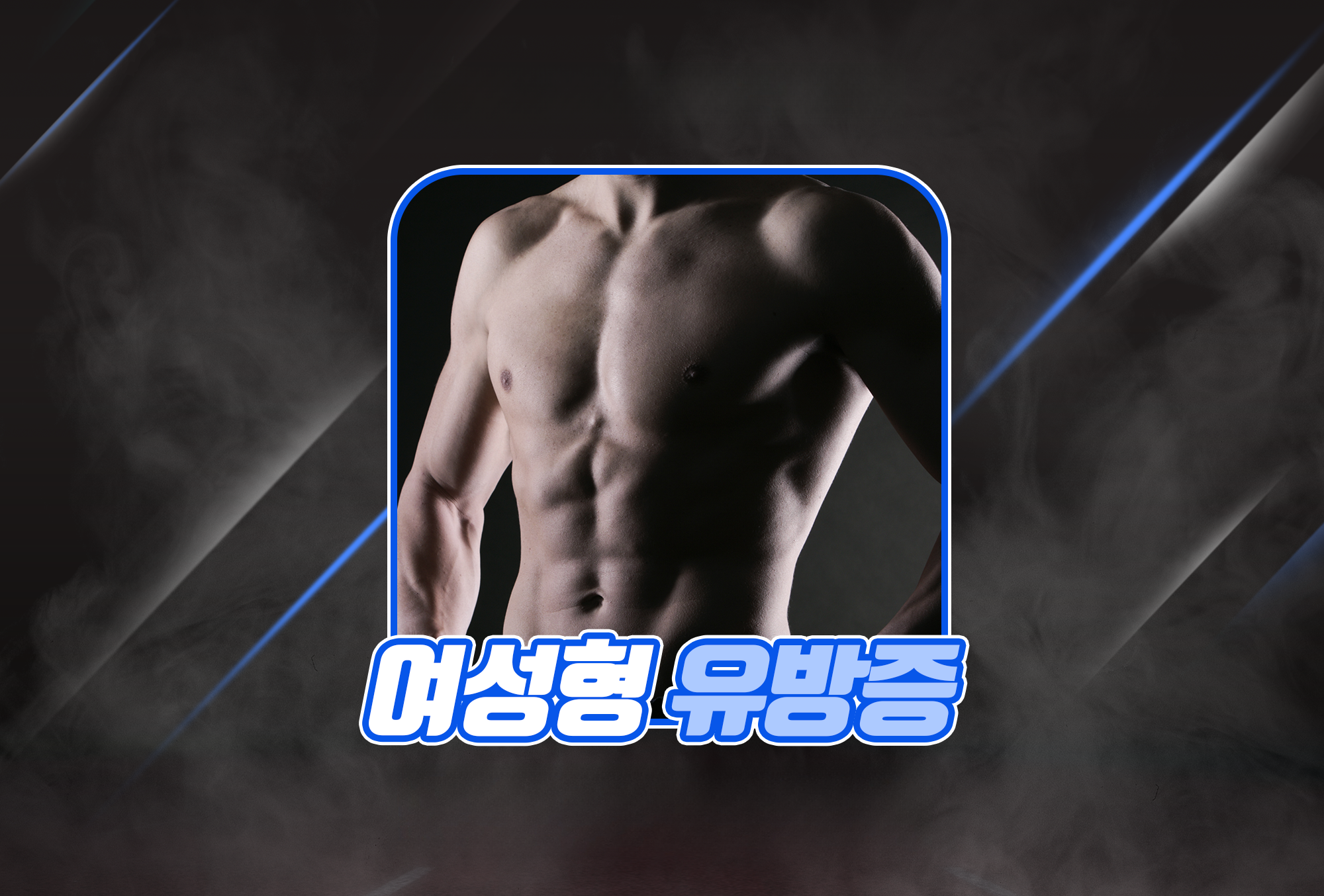 Hướng dẫn phẫu thuật nữ hóa tuyến vú (gynecomastia) tại Thẩm mỹ Hyundai