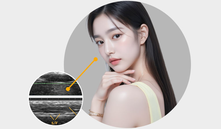 Thiết kế nâng cơ cân nhắc sự cân đối toàn khuôn mặt — xác định điểm bắt đầu bằng hình ảnh siêu âm thời gian thực